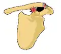 Classification type 2