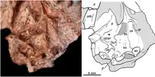 Photo and drawing of the underside of a skull