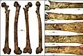 Burial 15. Perimortem fractures on the left femur.