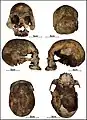 Burial 17 - Cranium