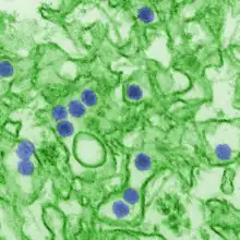 Electron micrograph of "Zika virus". Virus particles (colored purple) are 40&nbsp;nm in diameter, with an outer envelope and a dense inner core.